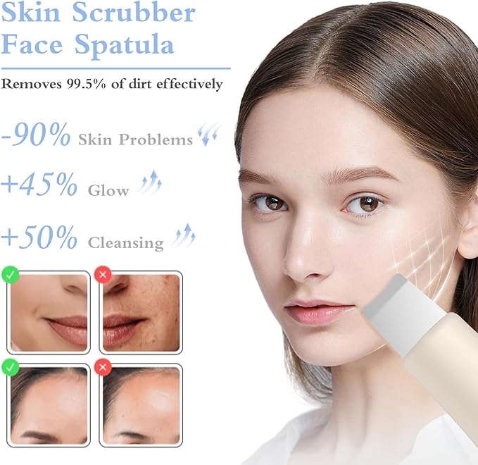 Skin Scrubber Face Spatula Skin Spatula Pore Cleaner Blackhead Remover Tools for Facial Deep Cleansing Skin Care Tool for Men and Women (Beige)-Velvo Beauty