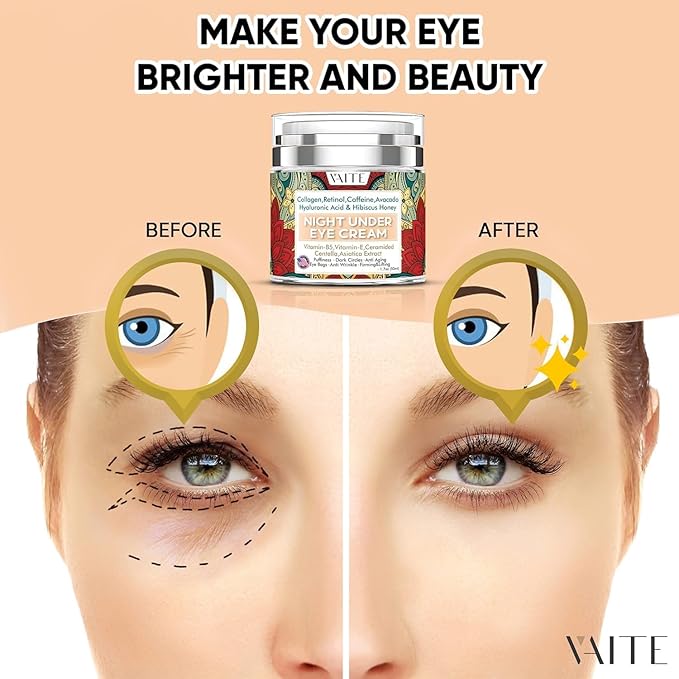 Under Eye Cream with Collagen, Retinol, Caffeine, Avacado Hyaluronic Acid & Hibiscus Honey for Night and Day with Vitamin B5, E for Puffiness Circles Anti Aging Eye Bags and Anti Wrinkle-Velvo Beauty