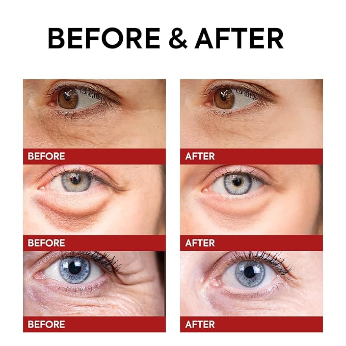 Rapid Reduction Retinol Eye Cream: Under Eye Cream Instantly Reduces Wrinkles Fine Lines Under Eye Bags Puffiness Dark Circles Crow's Feet - Rapid Face Lifting Tightening Firming 1 OZ/15g-Velvo Beauty
