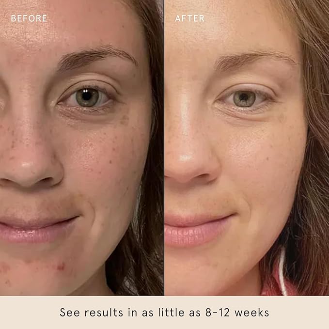 Barefaced Brightening Serum 1 Fl Oz Dark Spot Corrector with Kojic Acid, Arbutin, Azelaic Acid & Licorice, Anti-Aging, Hydrating, Fades Hyperpigmentation & Evens Skin Tone, Antioxidant-Powered Formula-Velvo Beauty