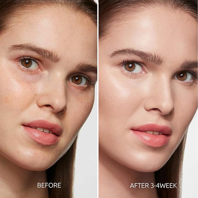 Dark Spot Remover for Face and Body - Dark Spot Corrector for Face - Sun Spots, Age Spots, Freckles & Melasma Remover - Brown Spot Corrector Evens Skin Tone for All Skin Type 1.7 Fl Oz-Velvo Beauty