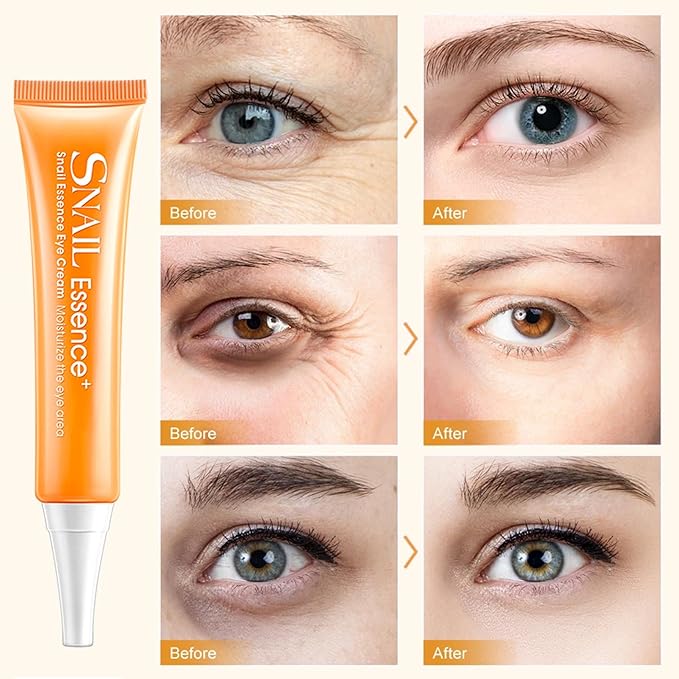 Snail Eye Cream for Dark Circles and Puffy Eyes Eye Bags Remover, Eye Cream Anti Aging, Under Eye Cream, Reduce Lines Wrinkles Puffiness and Dark Circles for All Skin Types-Velvo Beauty