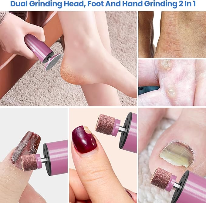 Electric Foot Callus Remover, 2 in 1 | 6 Speed Adjustable Foot File Nail Grinder with Sandpaper Disks, Professional Sander Pedicure Tool for Feet Dead Skin, Self Care Gifts for Women Mom Lover Friends-Velvo Beauty