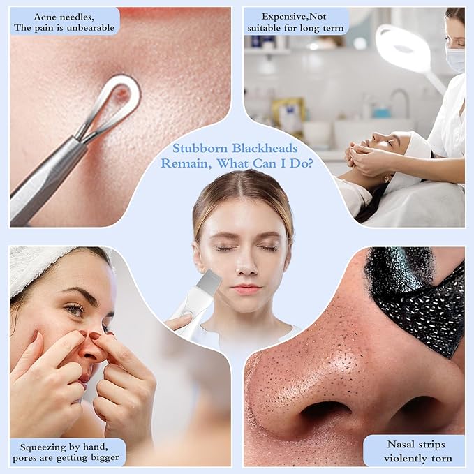 Skin Scrubber Face Spatula Skin Spatula Pore Cleaner Blackhead Remover Tools for Facial Deep Cleansing Skin Care Tool for Men and Women (White)-Velvo Beauty
