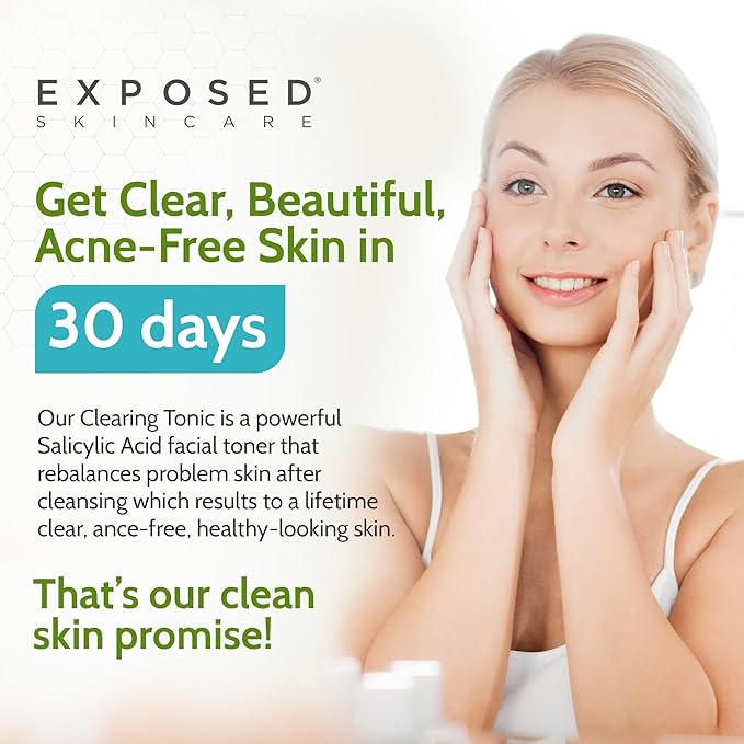 Exposed Skin Care Clearing Tonic Facial Toner with 1% Salicylic Acid and Witch Hazel for Acne Treatment – Pore Minimizing Toner to Prevent Breakouts, Reduce Redness and Balance Skin – Step 2 (4 fl oz)-Velvo Beauty