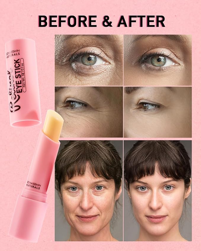 Under Eye Stick For Puffiness: Retinol Under Eye Treatment Reducing Eye Bags and Dark Circles - Eye Balm for Fine Lines, Wrinkles and Puffiness, Eye Cream for Late Nights,-Velvo Beauty