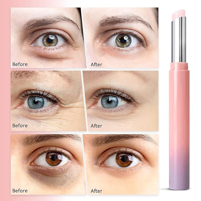 Eye Cream for Dark Circles & Puffiness: Instant Eye Bag Remover Puffiness Treatment, Retinol Eye Stick Bag Blam for Anti Aging - Repair Fine Lines, Crow's Feet & Wrinkles Visibly For Women and Men-Velvo Beauty