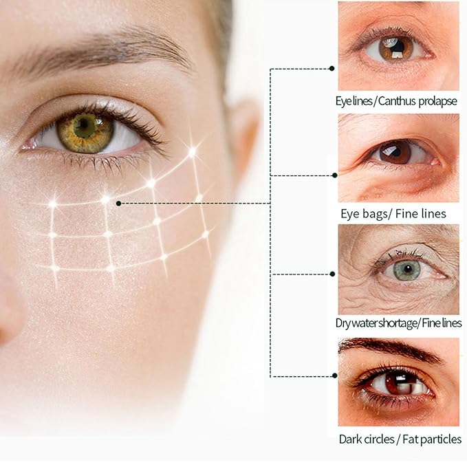 Eye Cream For Dark Circles, Anti Aging Eye Cream With Vitamin C, Hyaluronic-acid & Orange Extract, Under Eye Cream For Puffiness And Bags, Eye Cream For Reduce Fine Lines, Wrinkles & Dark Circles-Velvo Beauty