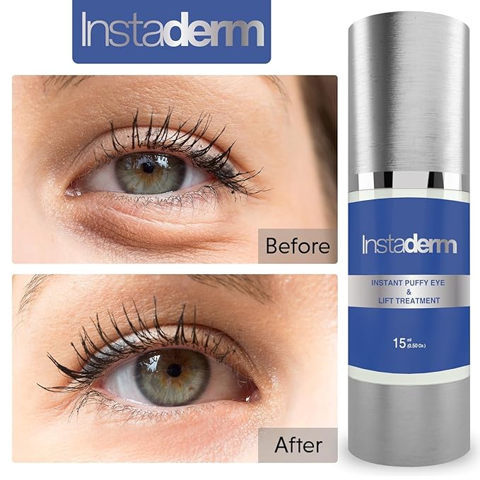 Instant Puffy Eye & Lift Treatment – Removes Under Eye Bags & Puffiness. Eliminate Dark Circles & Wrinkles. Naturally Ageless Hydrating Cream. Disappears Before Your Eyes Within Minutes.-Velvo Beauty