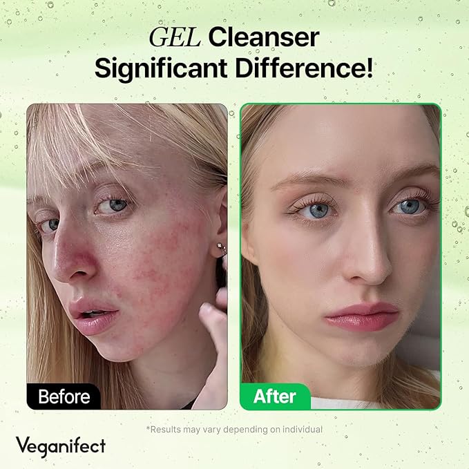 Gel Cleanser, Big Size, Gentle Exfoliation and Face cleanser for Sensitive Skin, Korean Skin Care, Vegan, 6.93 Fl Oz-Velvo Beauty
