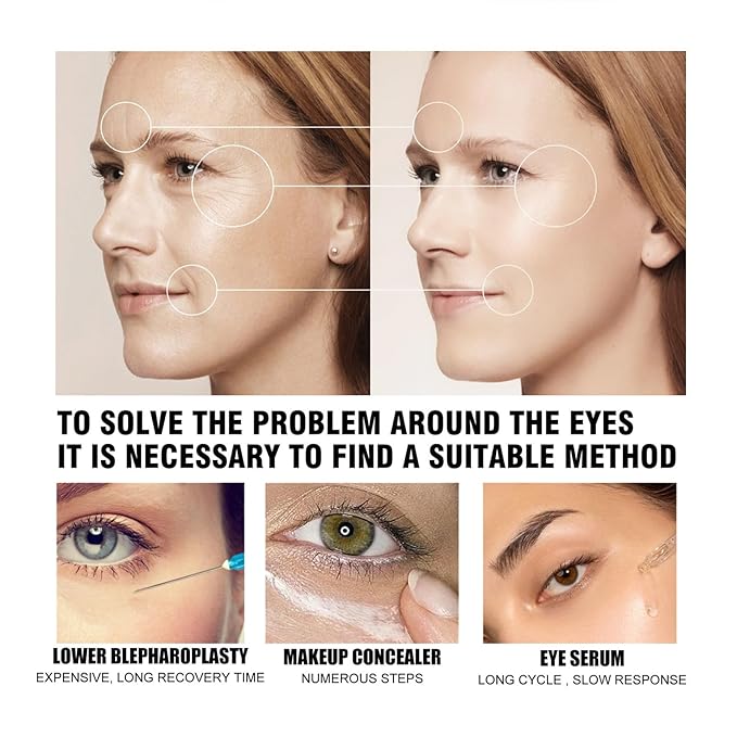 Temporary Eye Tightener Eye Cream For Puffiness And Bags Under Eyes,Instant Reduces Under-Eye Bags, Dark Circles&Puffiness, Instant Firm Eye Tightener Eye Bag Cream Anti Aging Fine Lines-Velvo Beauty