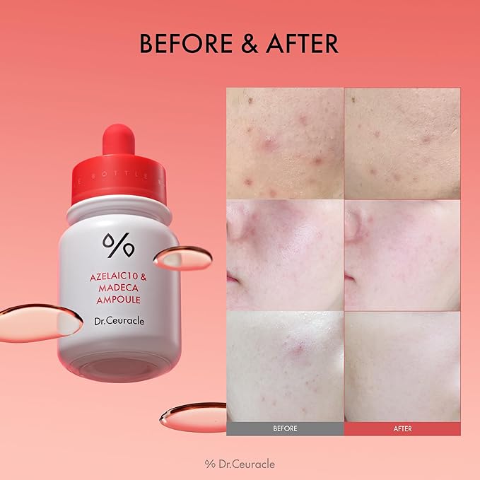 Dr.Ceuracle Azelaic Acid 10 & Madecassoside Ampoule - Redness Relief and Soothing Serum for Sensitive Skin and Blemish-Prone Spot Care, Korean Skincare-Velvo Beauty