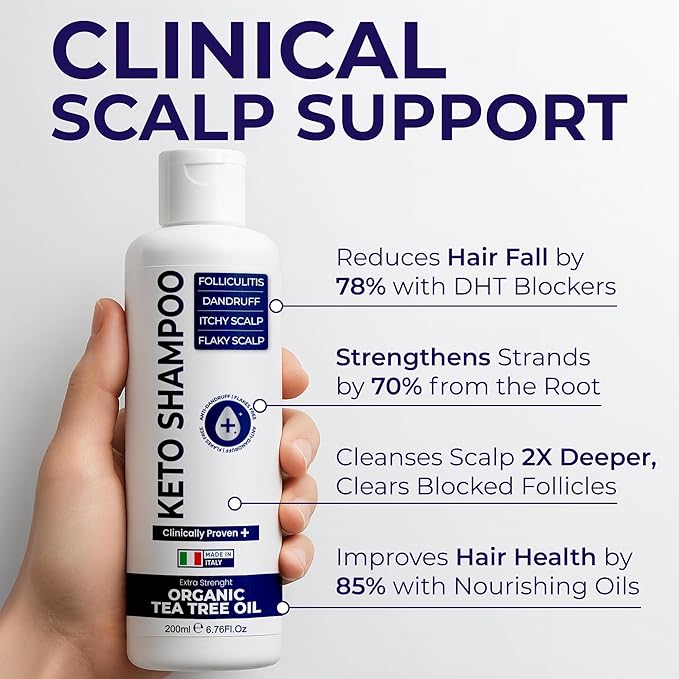 Scalp Psoriasis Shampoo, Flakes Shampoo Anti Dandruff, Itchy Scalp Treatment for Seborrheic Dermatitis & Folliculitis, Anti Fungal, Medicated Solution for Itchy, Flaky & Dry Hairs-Velvo Beauty