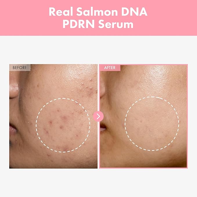 Pink Peptide 12 PDRN Serum With Salmon DNA PDRN 10,320ppm, 12 Peptides, Niacinamide, Skin glow, Hydrating, Moisturizing, Firming, Uneven Skin Tone, Korean Skincare, 33ml, 1.11 fl.oz.-Velvo Beauty