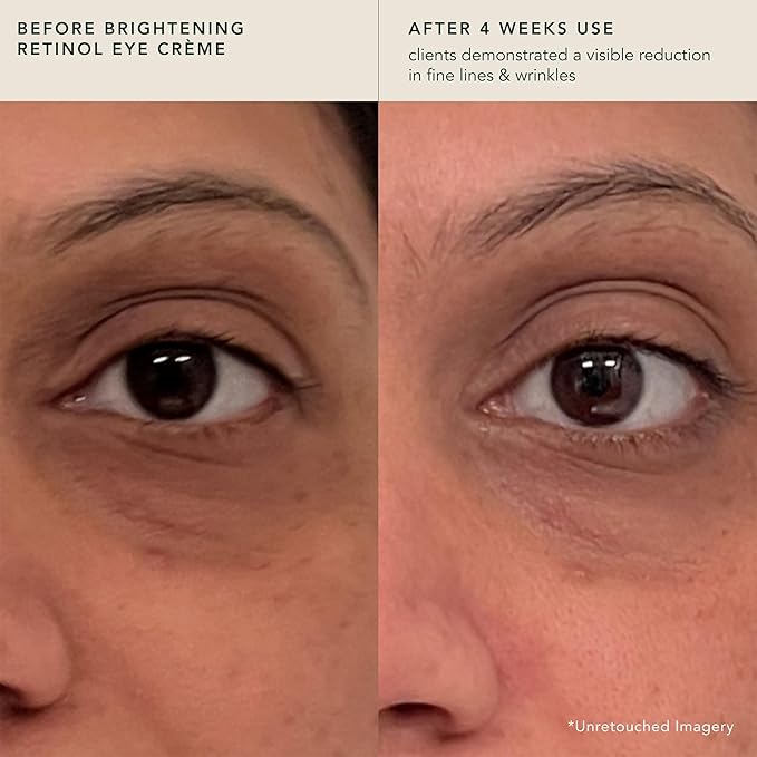 RANAVAT Brightening Retinol Eye Cream - Anti Aging Eye Cream and Dark Circle Corrector to Help Target Fine Lines - Enriched with Micro-Encapsulated Retinol, Bakuchi Seed, & Saffron (0.5 oz)-Velvo Beauty