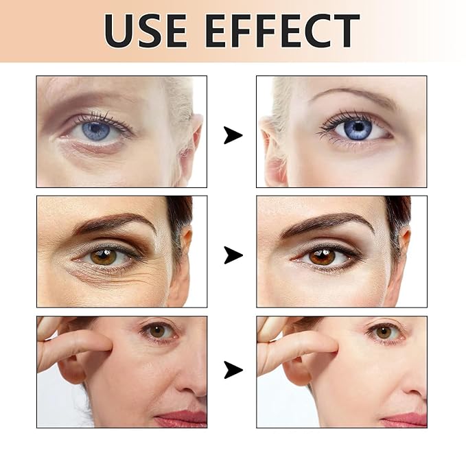 Eye Cream,Eye Tightener Cream, Eye Firming Cream,Under Eye Firming,Temporary Eye Tightener (2 PCS)-Velvo Beauty