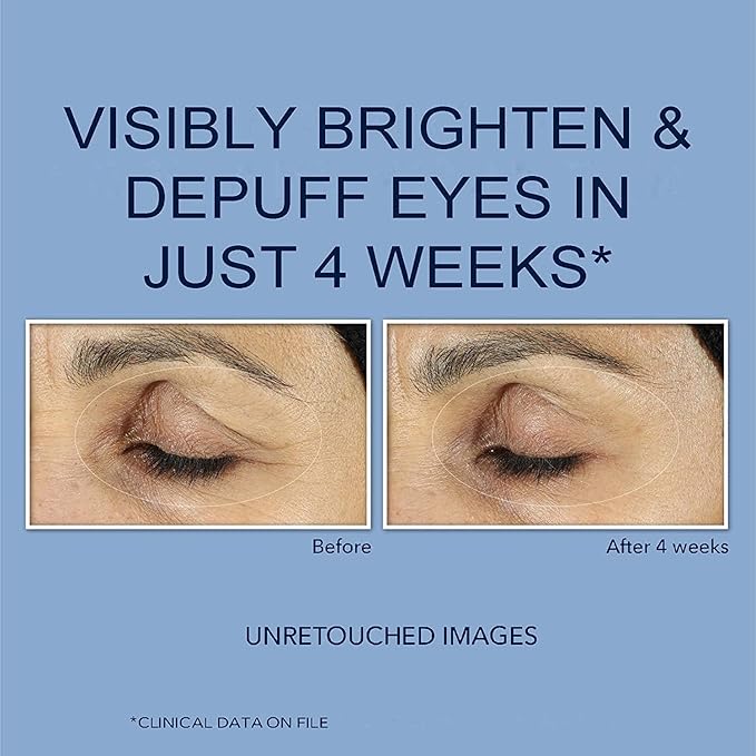 Retinol Polypeptide Eye Cream,Retinol Eye Cream for Dark Circles and Puffiness, Visible Results in 3-4 Weeks, Under Eye Cream for Anti Aging, for Puffiness and Bags to Reduce Fine Lines(2pcs)-Velvo Beauty