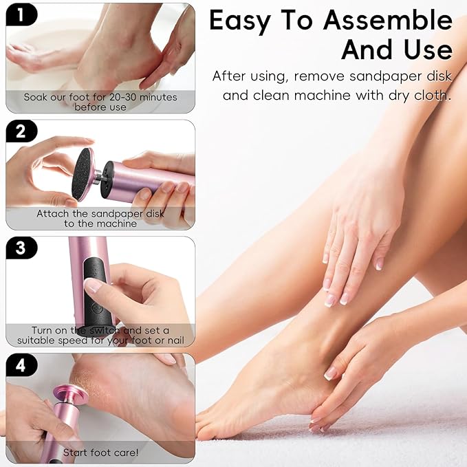 Electric Callus Remover,CHNYNJN Foot File Grinder Tool with Speed Controller and 20pcs Replacement Sandpaper and 10 Sand Rings Disk for Men Women Dead Dry Crack Skin Calluses-Velvo Beauty