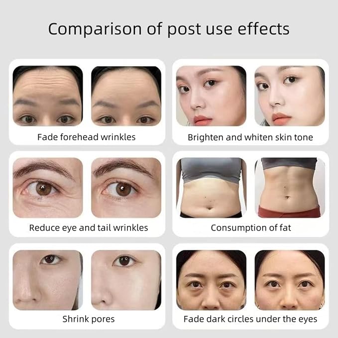Comfortable Home Beauty Instrument, Deep Firming Technology, Strong Skin Firming, Remove Black Spots and Whiten Skin to Keep Young-Velvo Beauty