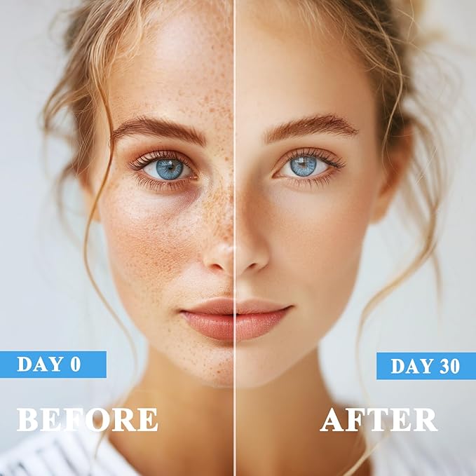 Dark Spot Remover for Face and Body, Dark Spot Corrector, Age Spot Sun Spot Freckles Dark Spot Remover, Melasma Treatment for Face, Advanced Skin Care Cream for Women and Men (1.7 Fl Oz)-Velvo Beauty
