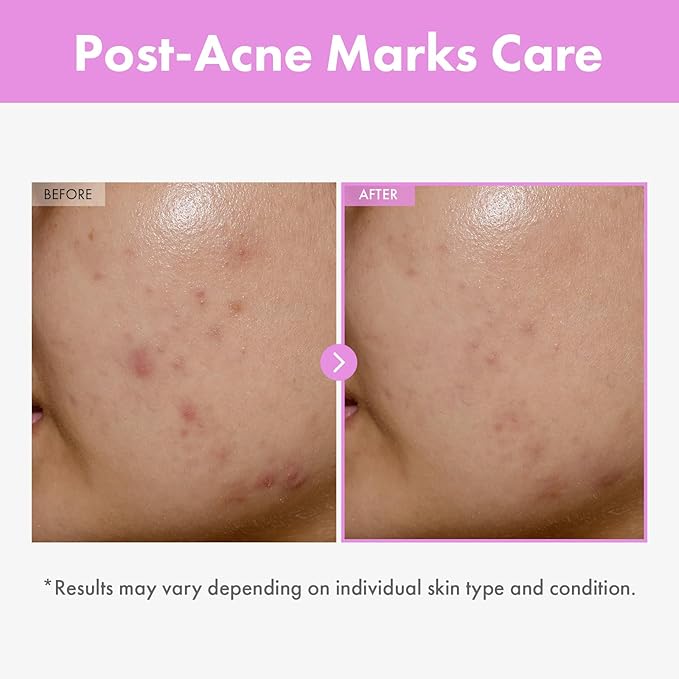 9 Peptide Skin Booster Serum, Niacinamide & Hyaluronic Acid Skin Renewal Boosting Facial Essence for All Skin Types, Korean Skin Care, Paraben Free, 150ml, 5.07 fl.oz.-Velvo Beauty