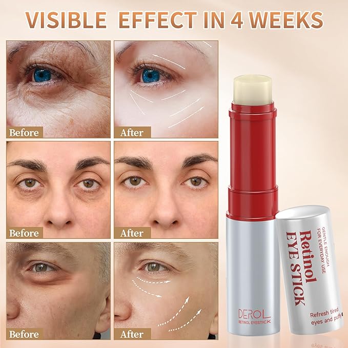 Retinol Eye Cream, Wrinkle Repair Eye Cream for Dark Circles, Under Eye Bag Cream with Retinol & Hyaluronic Acid, Eye Cream Anti Aging to Fight Fine Lines, Reduce Eye Bags,Wrinkles in 3-4 Weeks-Velvo Beauty