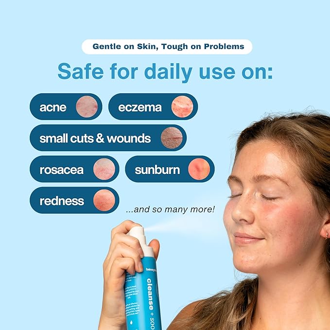 Hypochlorous Acid Spray – HOCl Face & Skin Mist for Acne, Eczema & Irritation – Multi-Purpose Skin Repair – Eyelid Cleanser, Post-Workout, Post-Procedure, Scalp & Sensitive Skin – 6.8 oz-Velvo Beauty