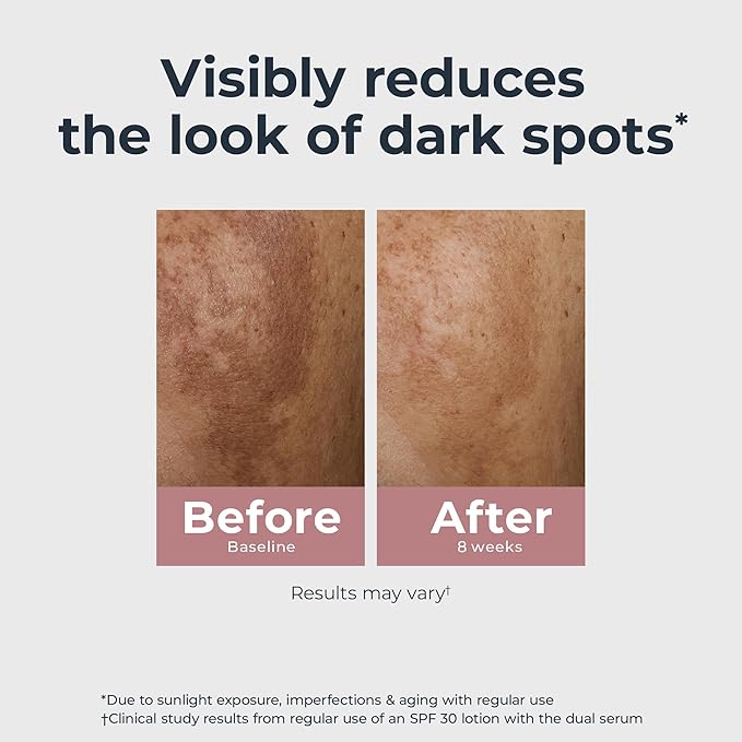 Eucerin Radiant Tone Dual Serum Dark Spot Corrector, Dark Spot Serum with Thiamidol and Hyaluronic Acid, Helps Visibly Reduce the Look of Persistent Dark Spots, 1 Fl Oz Bottle-Velvo Beauty