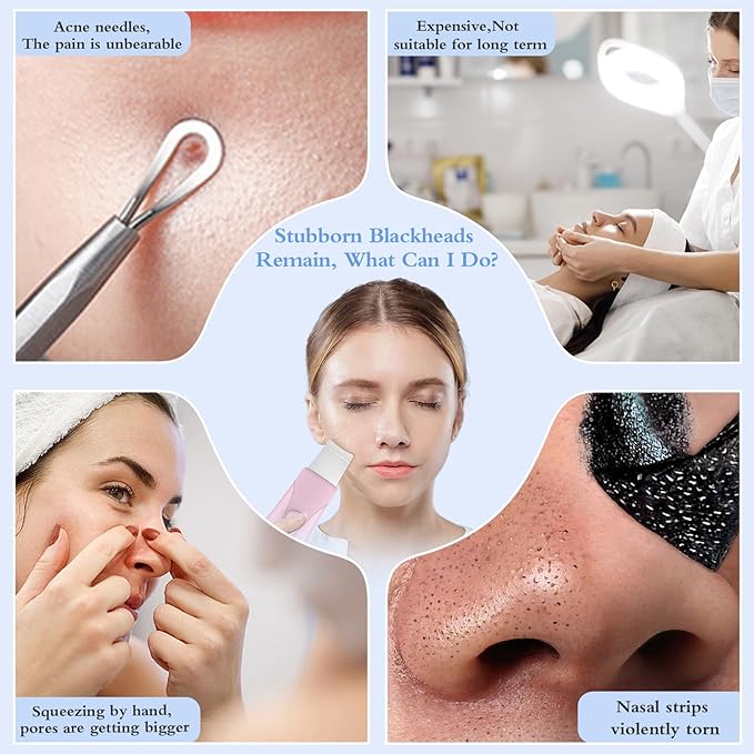 Skin Scrubber Face Spatula Skin Spatula Pore Cleaner Blackhead Remover Tools for Facial Deep Cleansing Skin Care Tool for Men and Women (Pink)-Velvo Beauty