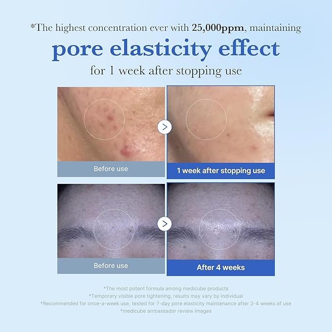 medicube Zero Exosome Shot 25,000 PPM Spicule Facial Serum | Liquid Skin Booster Serum | Exosome, AHA+BHA+PHA | Pore Care, Dead Skin Cells, Skin Texture | Korean Skin Care 0.43 fl.oz-Velvo Beauty