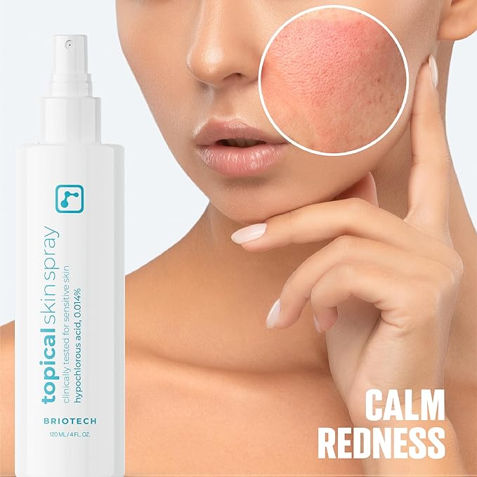 BRIOTECH Topical Skin Spray, Hypochlorous Acid Spray for Sensitive Skin, HOCl Facial Mist, Full Body Support Against Irritation, Calm Redness, Soothe Foot & Scalp, 2 oz Travel Size-Velvo Beauty