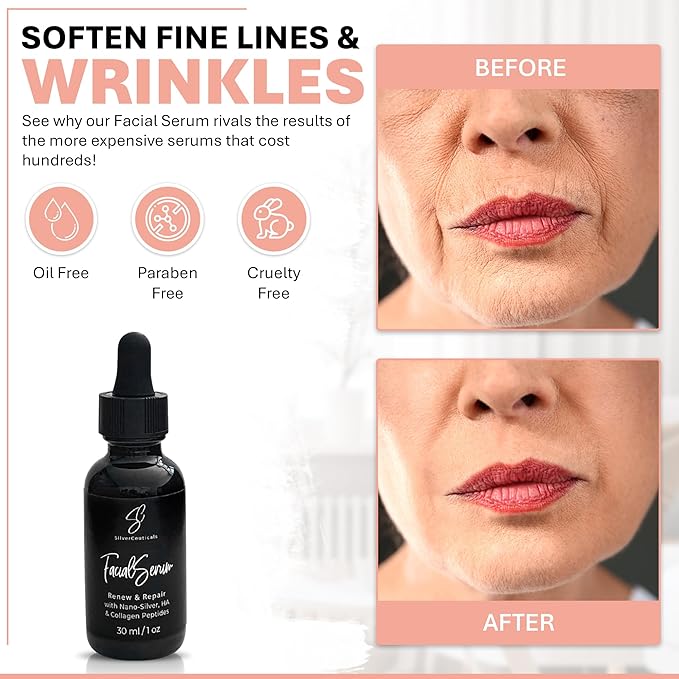 Facial Serum - Fight Blemishes - Acne Pimples & Breakouts - Soften Fine Lines & Wrinkles - Hydrate & Repair Damaged Skin - Clear Complexion - Collagen - 2 Types of Hyaluronic Acid - Anti Aging - 1oz-Velvo Beauty