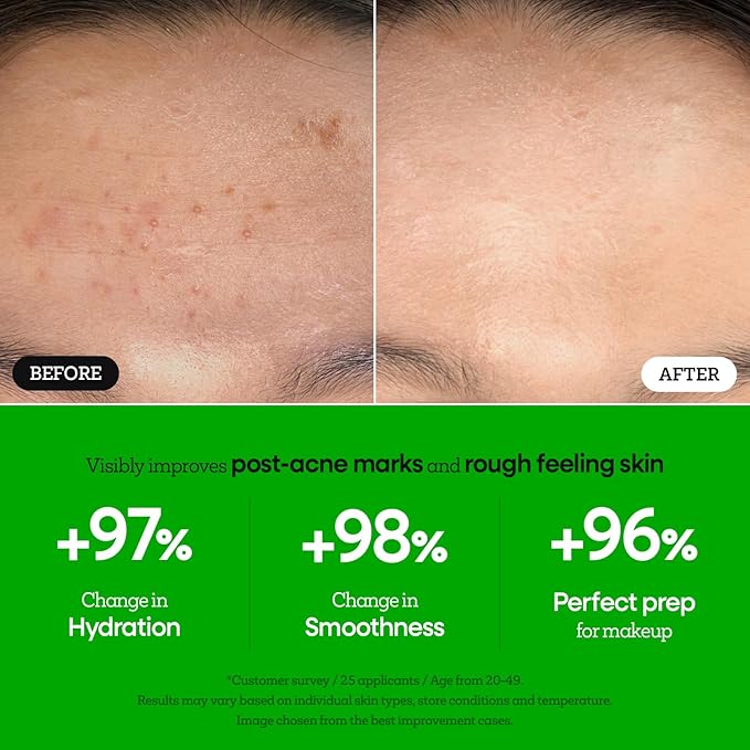 Nature Republic The First Peptide Boosting Serum, 8 Peptides, Niacinamide & Triple Hyaluronic Acid Complex,17 Amino acids,for All Skin Types, Korean Skin Care150ml/5.07 fl oz-Velvo Beauty