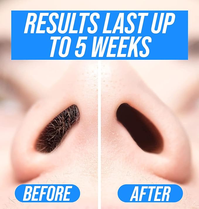 KENASHII Nose Wax Kit | 100 g Wax, 24 Applicators | Hair Removal Kit for Men and Women | Includes Balm Wipes and Mustache Guards | Lasts up to 5 Weeks-Velvo Beauty