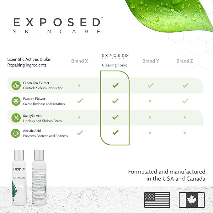 Exposed Skin Care Clearing Tonic Facial Toner with 1% Salicylic Acid and Witch Hazel for Acne Treatment – Pore Minimizing Toner to Prevent Breakouts, Reduce Redness and Balance Skin – Step 2 (4 fl oz)-Velvo Beauty