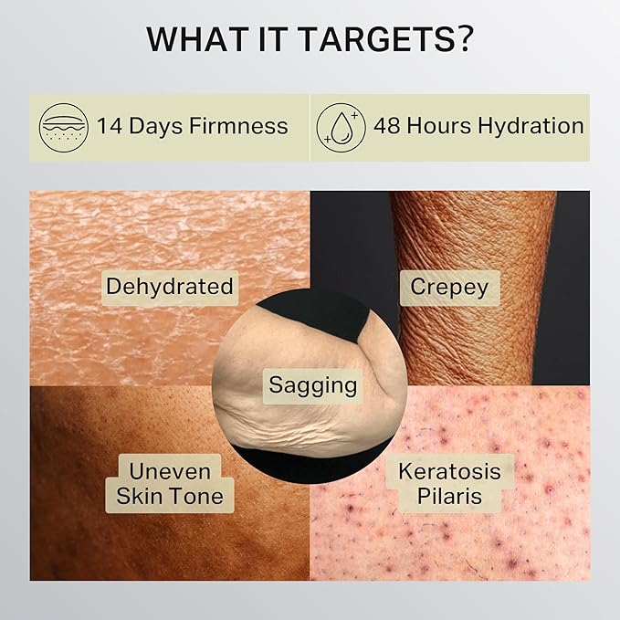 Ultra-Size Firming Retinol Body Lotion for Crepey Skin & Keratosis Pilaris with 0.05% Retinol, AHA, Collagen, Body Cream, Anti Aging Moisturizer 10.14 fl oz-Velvo Beauty