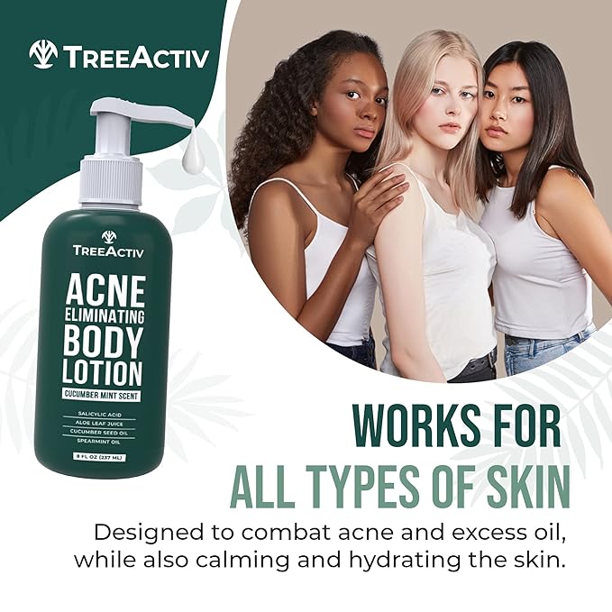 TreeActiv Acne Eliminating Body Lotion 8 fl oz | Clears Body, Back, Butt and Shoulder Acne | Anti-Acne Moisturizer | Prevents Future Breakouts | Cucumber Mint Scent-Velvo Beauty