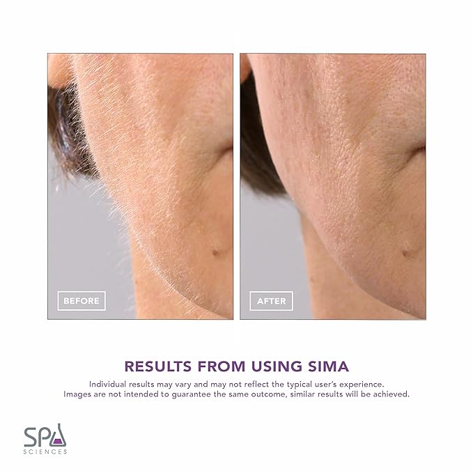SPA SCIENCES - SIMA Patented Dermaplane Razor for Women Face – Painless 2-in-1 Facial Exfoliation & Peach Fuzz Hair Removal – Anti-Aging – 3 Speeds – Rechargeable – 7 Weeks Treatment-Velvo Beauty