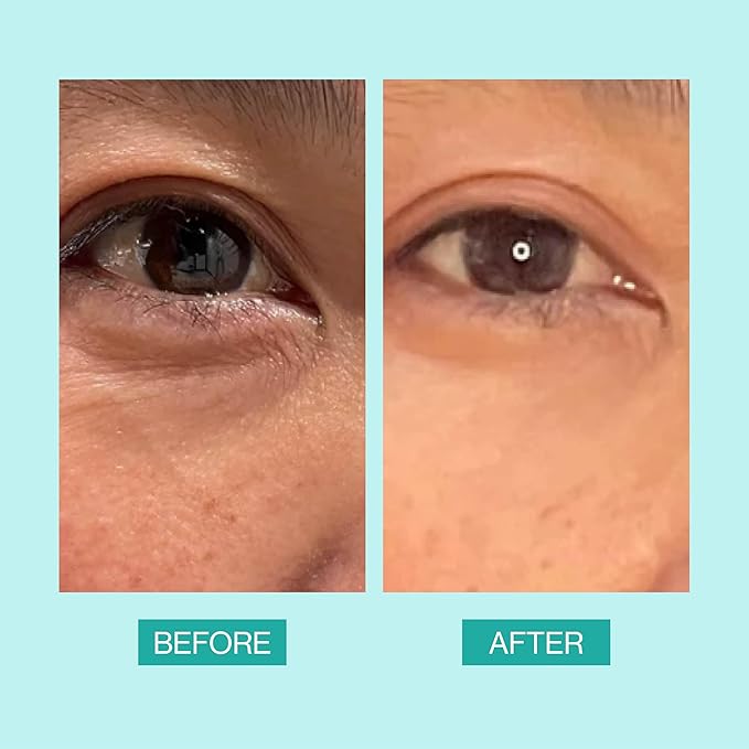 eb5 Daily Repair Eye Treatment | Under Eye Cream for Dark Circles and Puffiness | Anti-Aging Eye Cream with Peptides for Women and Men - 0.50oz-Velvo Beauty