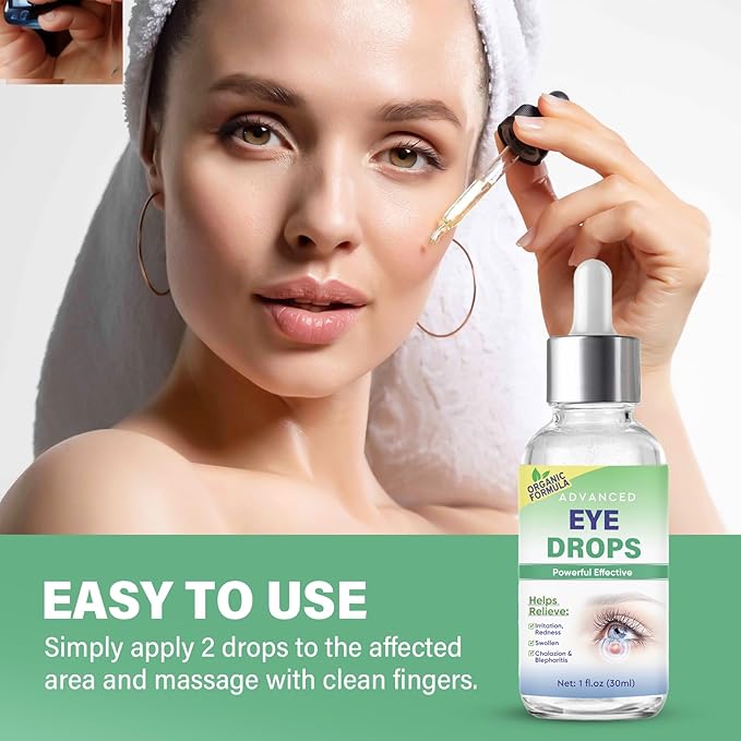 Stye Eye Treatment, Stye Eye Drops Serum for Styes Chalazion and Blepharitis, Chalazion Remover Fast Relief, Restore Healthier Eye Skin, 30ml-Velvo Beauty