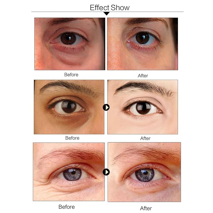 Under Eye Patches For Dark Circles, Aloe Vera Eye Mask For Puffiness, Hydrating Eye Gel Pads For Eye Bags And Wrinkles Under Eye Treatment, Improve And Firm Eye Skin Reduce Fine Lines - 30 Pairs-Velvo Beauty