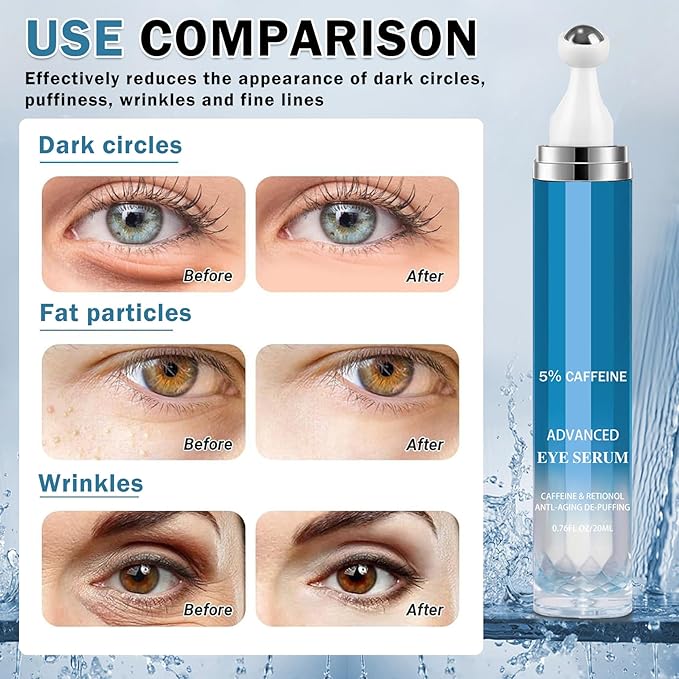 Caffeine Under Eye Cream for Dark Circles Eye Cream for Puffiness and Bags Under Eyes,Eye Roller for Puffy Eyes and Firming,Wrinkle Reducing Crema Para las Ojeras-Velvo Beauty