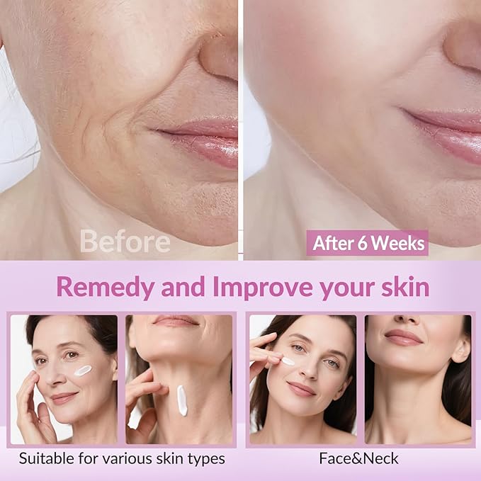 Neck Firming Creams for Tightening and Firming, Moisturizer Face Cream with Collagen, Hyaluronic Acid, Day & Night Anti-Aging Skin Tightening Cream Neck, Décolleté & Face – 1.7Fl Oz-Velvo Beauty