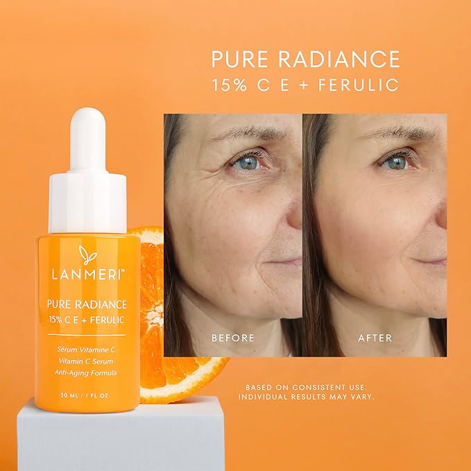 Vitamin C Serum With Ferulic Acid: CE Ferulic Face Serum With 15% Ascorbic Acid, Vitamin E, Hyaluronic Acid - Vit C Serum for Deep Hydration, Brightening, Anti-aging, Anti Wrinkle, Skin Repair 1 Fl Oz-Velvo Beauty