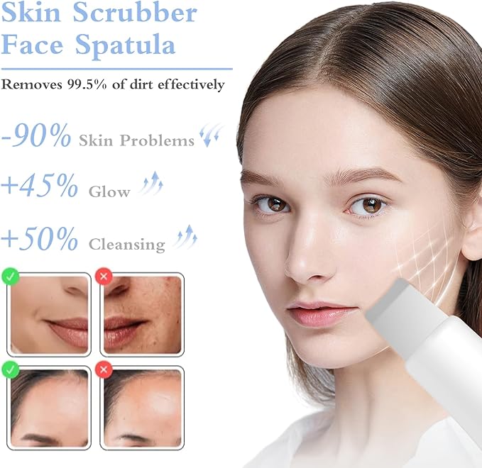 Skin Scrubber Face Spatula Skin Spatula Pore Cleaner Blackhead Remover Tools for Facial Deep Cleansing Skin Care Tool for Men and Women (White)-Velvo Beauty