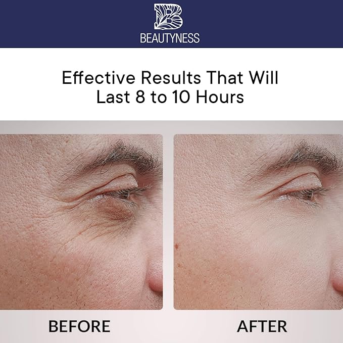 Instant Ageless Eye Cream – Anti Wrinkle Cream, Removes Under Eye Puffiness, Bags, Expression Lines, & Dark Circles. Powerfully Tighen & Lifts Sagging Skin. Disappears Before Your Eyes In Minutes.-Velvo Beauty