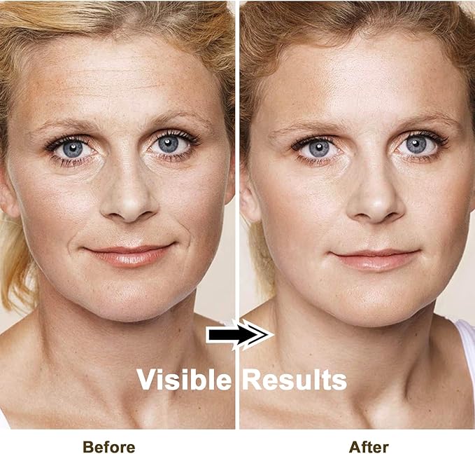 Lefay Face Skin Tightening Machine - Radio Frequency Anti-Aging Device Microcurrent Face Massager Lifting, Firming, Toning, Wrinkles Reduction De-Puffiness for Facial and Neck-Velvo Beauty