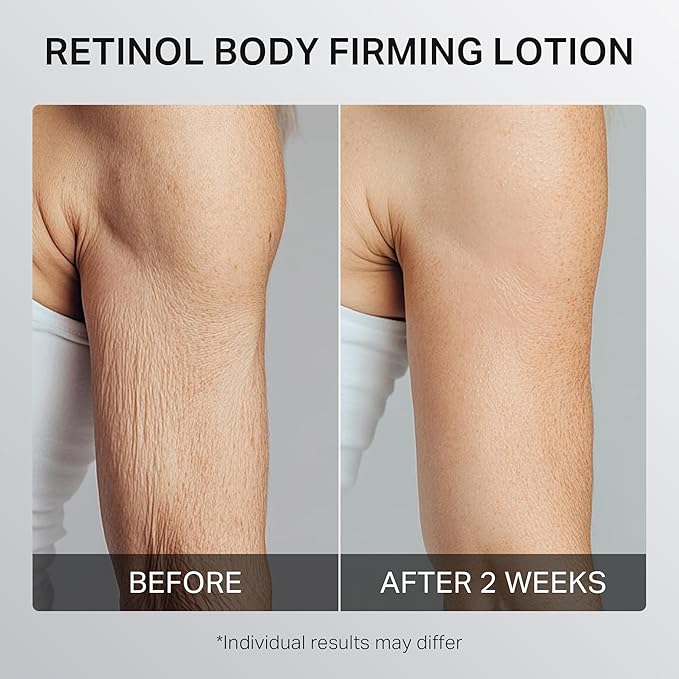 Ultra-Size Firming Retinol Body Lotion for Crepey Skin & Keratosis Pilaris with 0.05% Retinol, AHA, Collagen, Body Cream, Anti Aging Moisturizer 10.14 fl oz-Velvo Beauty