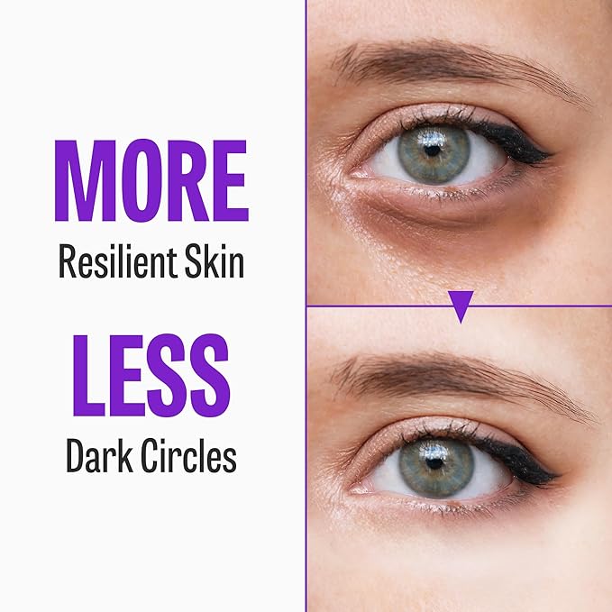 Time Return Melatonin Eye Cream for Dark Circles & Fine Lines | Clarifying Eye Cream for Bags Under Eyes | Firming Eye Cream for Fine Lines| Moisturizing Eye Cream for Eye Care (0.70 oz)-Velvo Beauty
