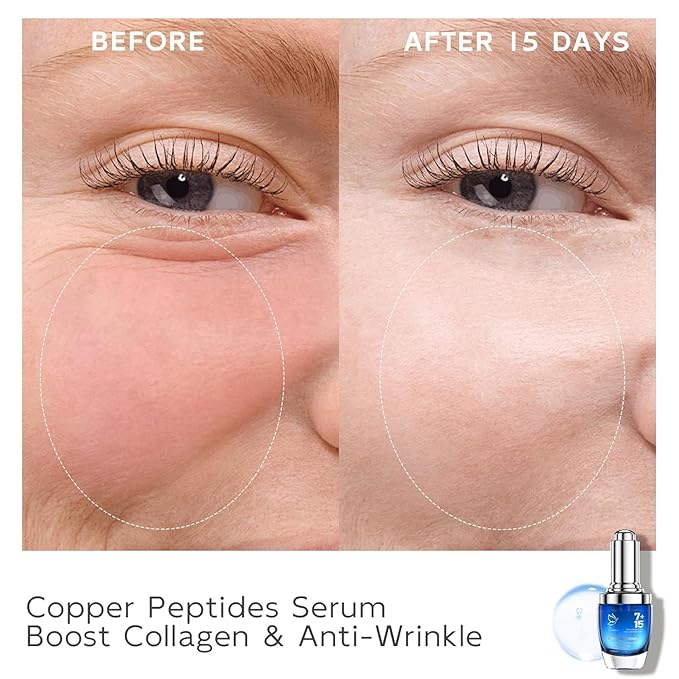Copper Peptides Serum for Face - Peptides Collagen Renewal & Anti-Aging Serum - GHK-Cu, EGF, Hyaluronic Acid,Collagen - Anti Wrinkle, Firming, Moisturizing-Korean Skin Care,25mL/0.88 Fl Oz-Velvo Beauty